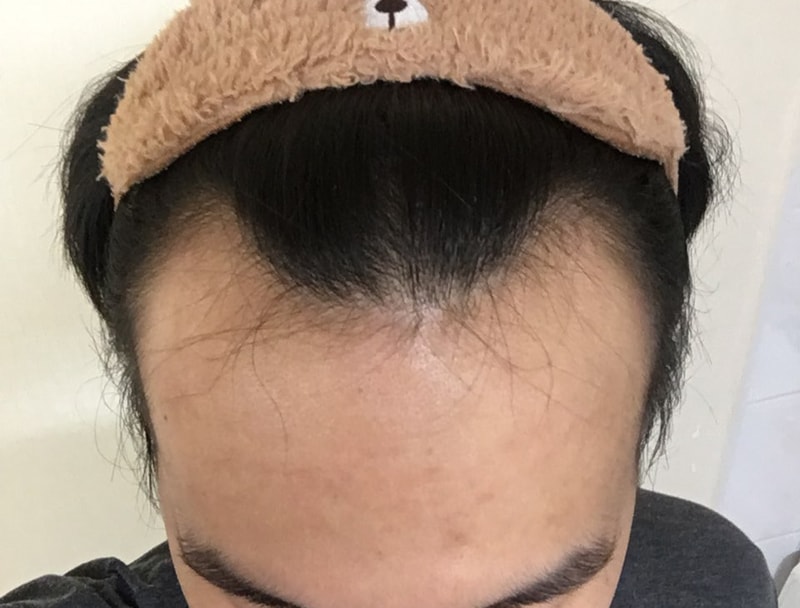 20180712_090553731.jpg