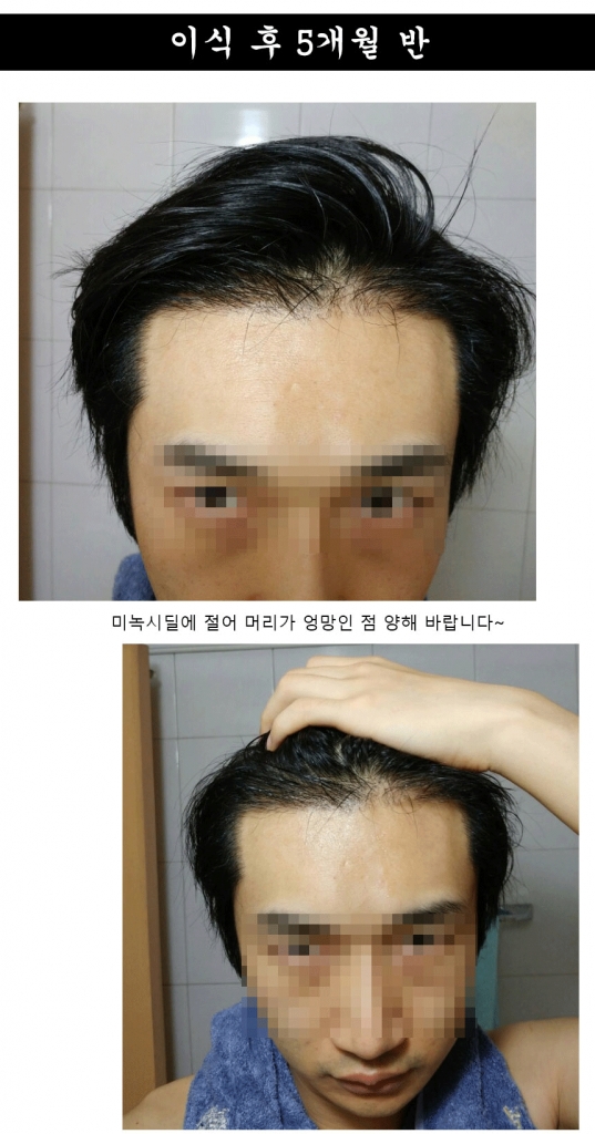 170일후기_02.gif