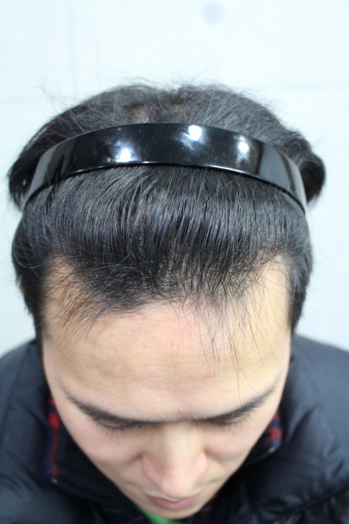 회전_IMG_3152.JPG