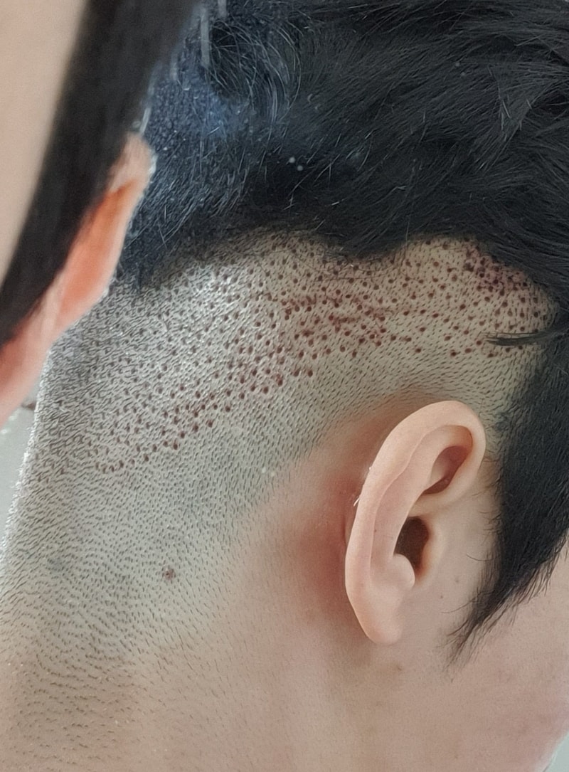 2일뒤.jpg