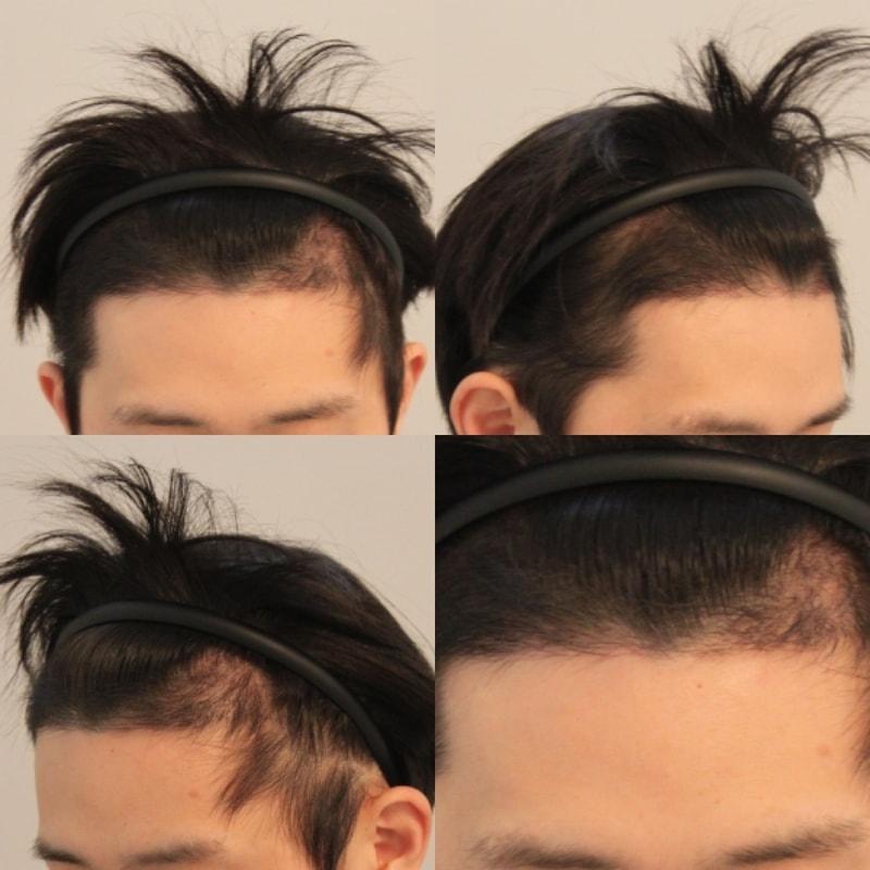 암흑기 서서이 끝나갑니다