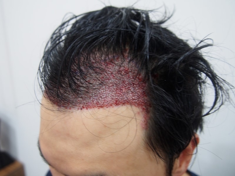 수술후2.JPG