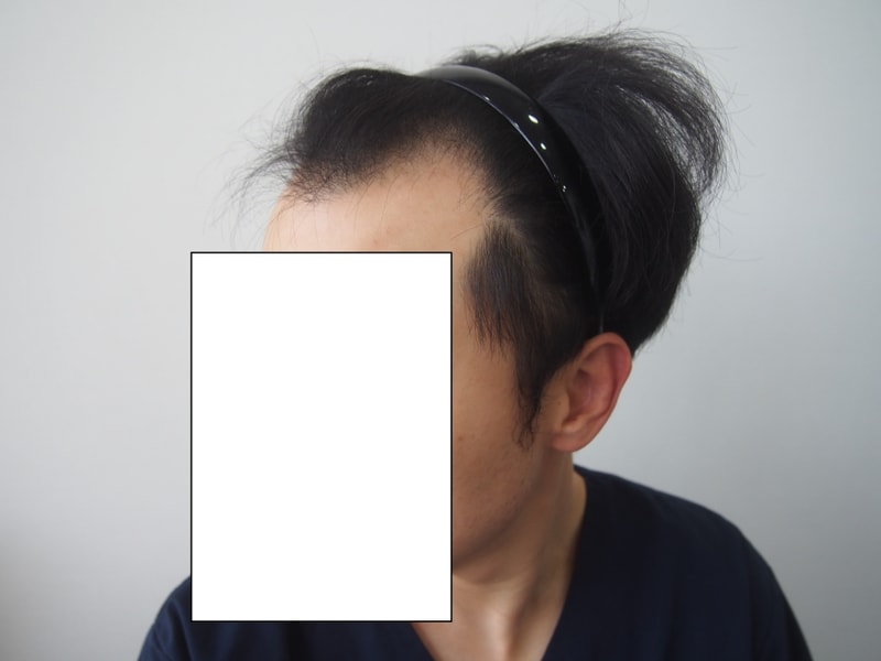 측면2.jpg