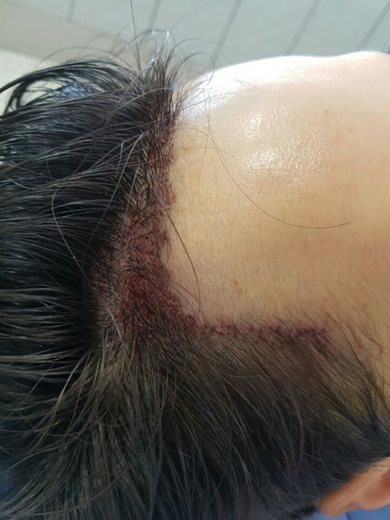 KakaoTalk_20170627_173538341.jpg
