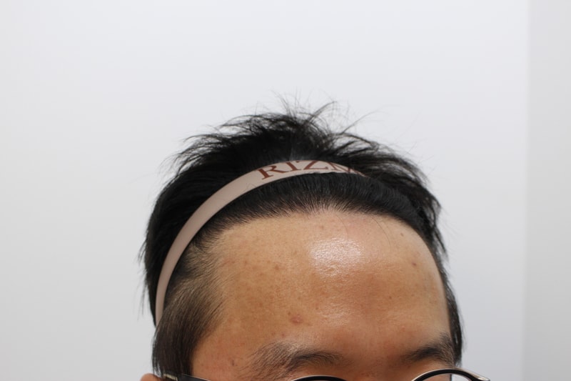 후2.jpg