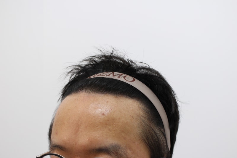 후3.jpg