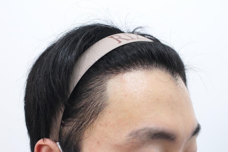 8개월차 측면.jpg