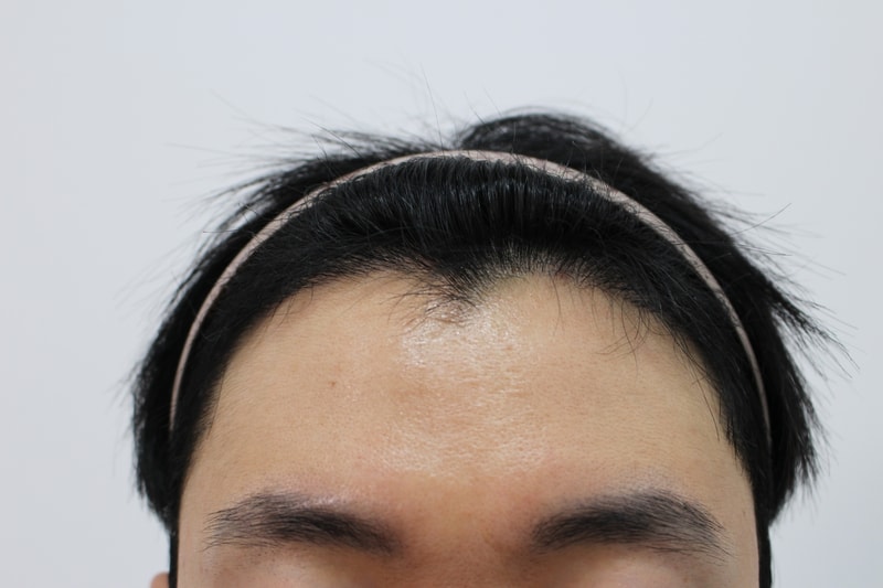 8개월차 정면.jpg