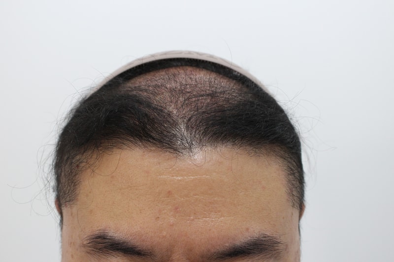 after 2 week.jpg