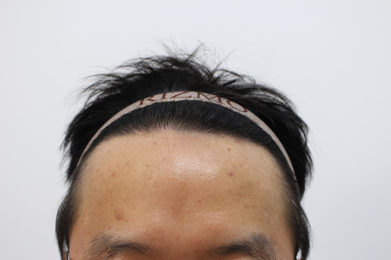 후.jpg