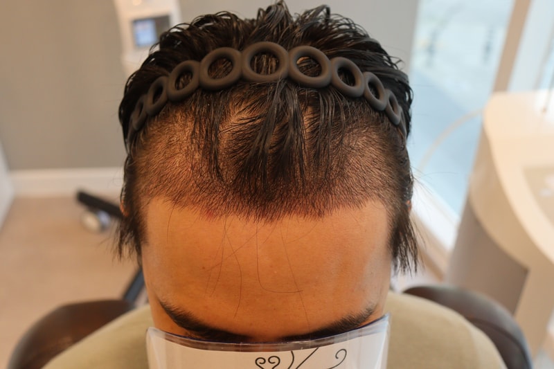 2주경과.jpg