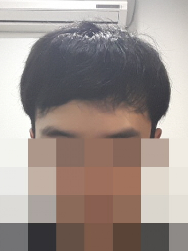 이식다음날3.jpg