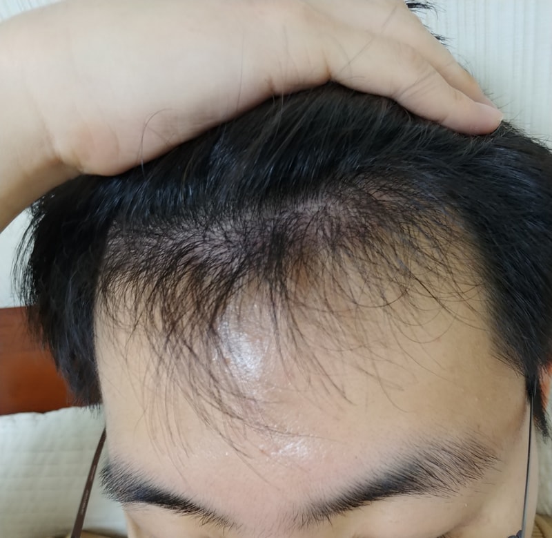 It's been 6 months since I had my new hair done.