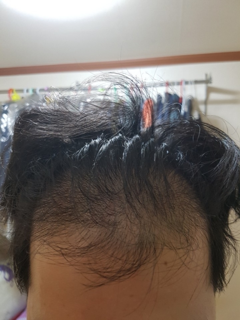 KakaoTalk_20170729_103039920.jpg