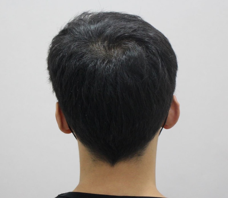 04.수술후.JPG