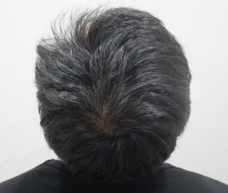 03.수술후.JPG