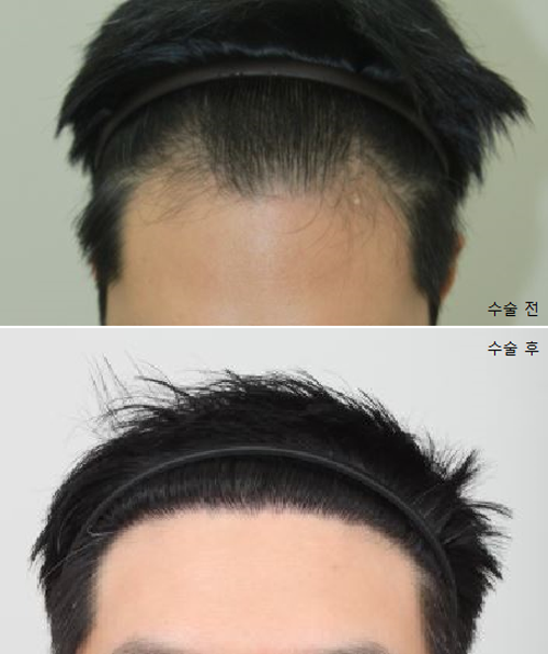 [크기변환]편집2.png