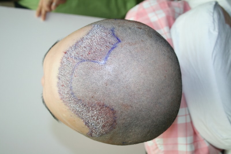 확실히 결정이 쉽지는 않았네요..