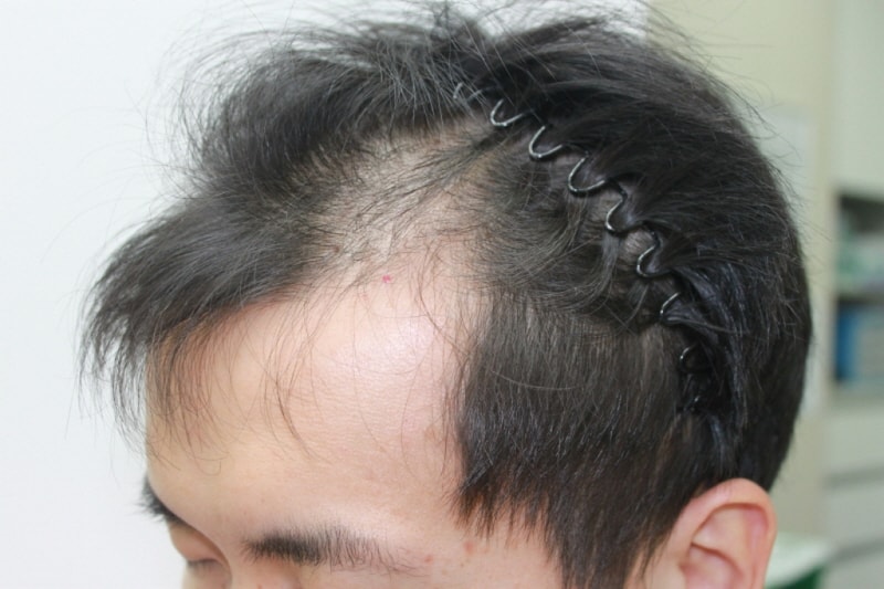 0IMG_9847.JPG