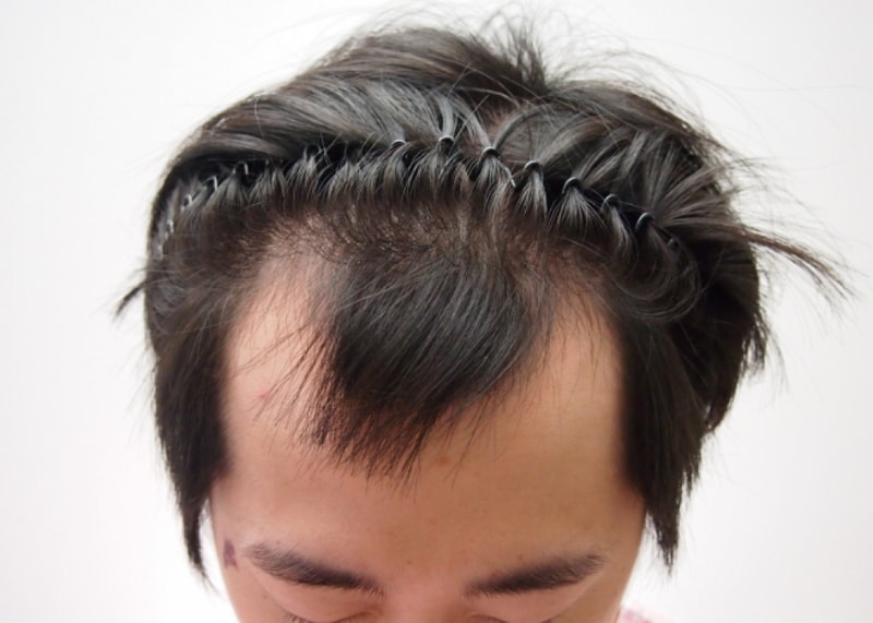 20150309_141556.png