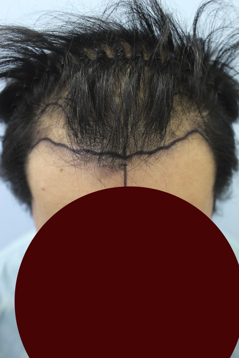 001.jpg