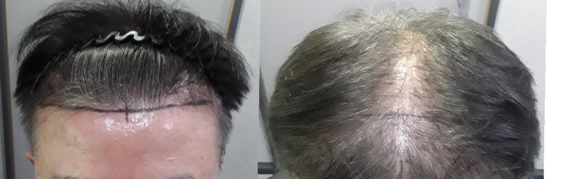 다나에서 하고 결과가 너무 좋습니다 (16개월)