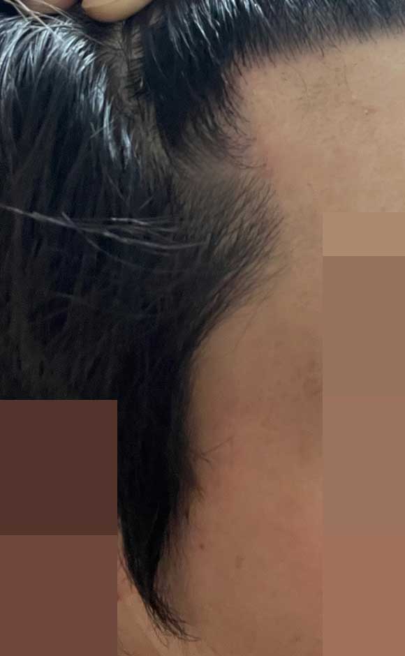 11개월옆모습가까이서.jpg