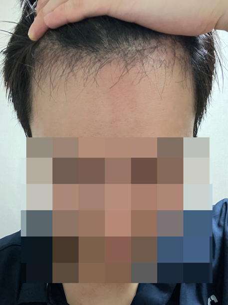 2달차암흑기대박.jpg