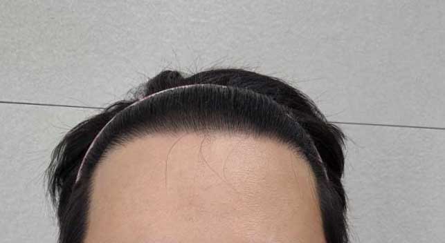 3636363.jpg