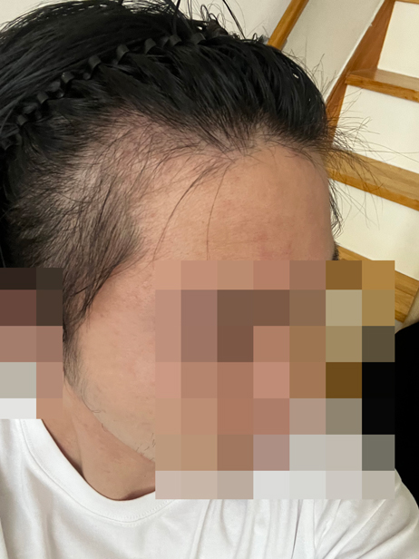3개월암흑긔.jpg