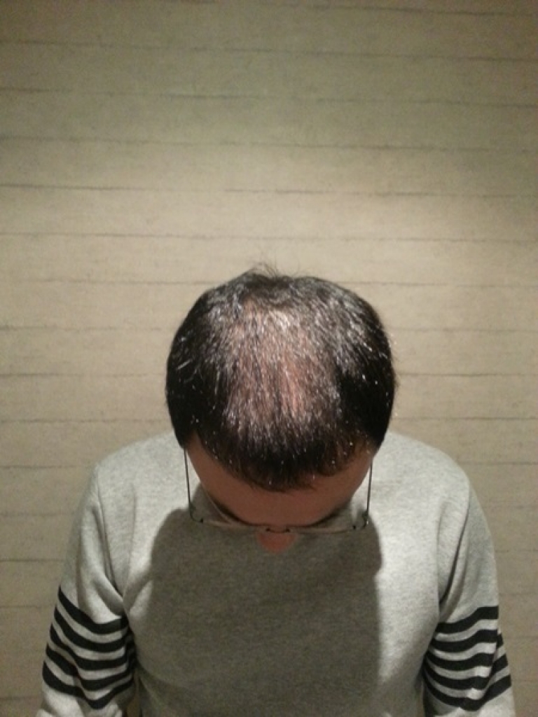20141130_222913.jpg