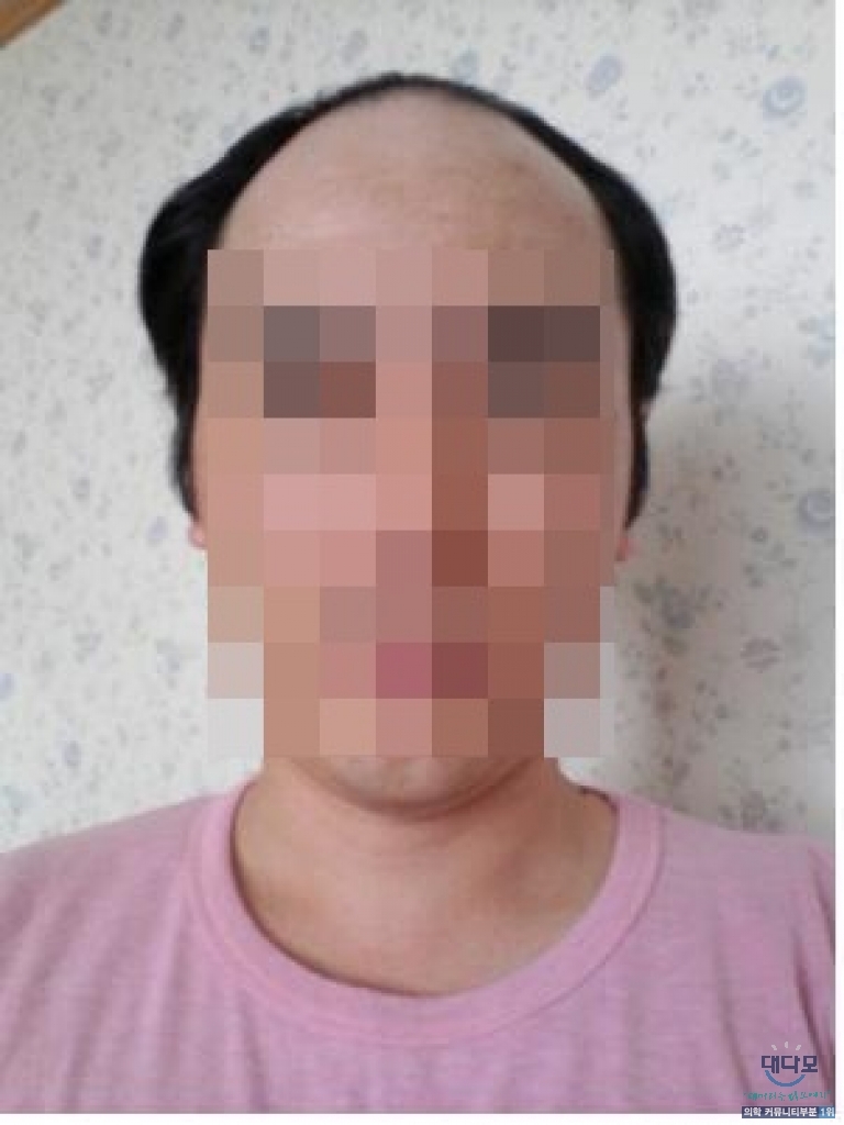 6개월차 다나후기입니다~