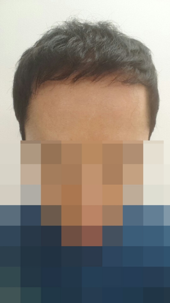 10개월.jpg