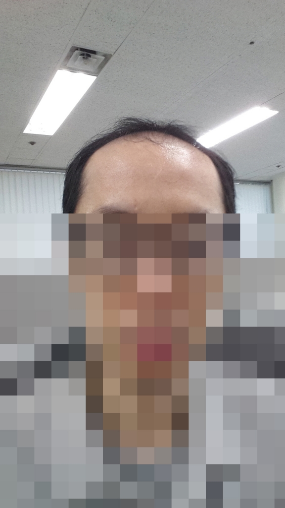 수술전.jpg