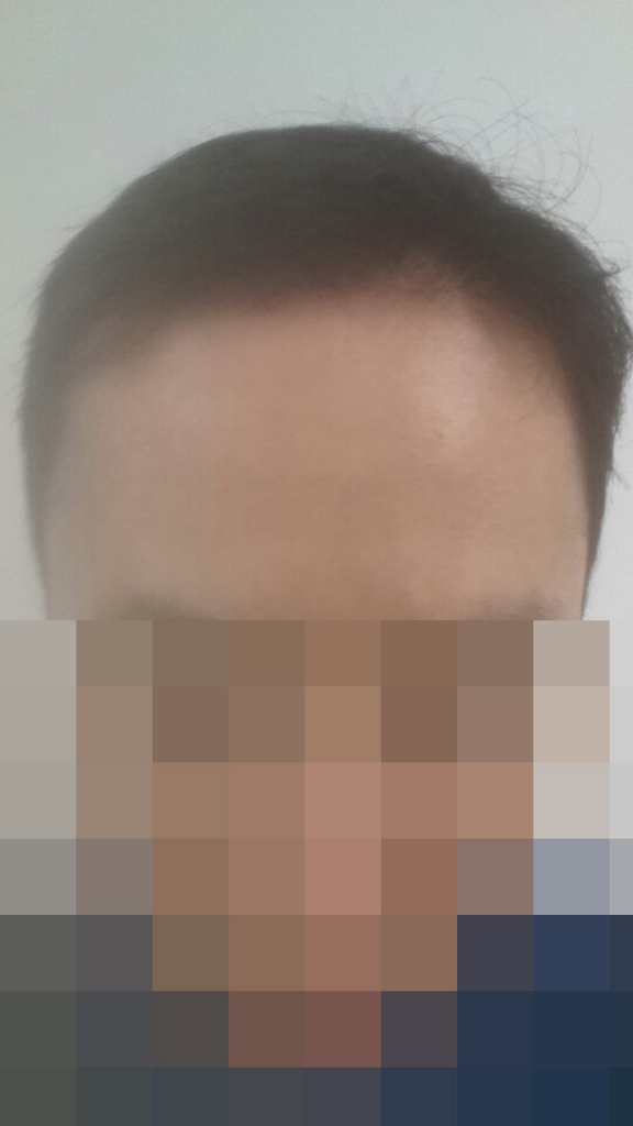 17개월.jpg