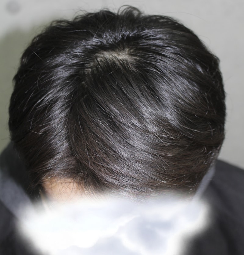 KakaoTalk_20170821_141859204.png