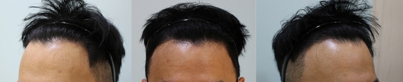 03.jpg