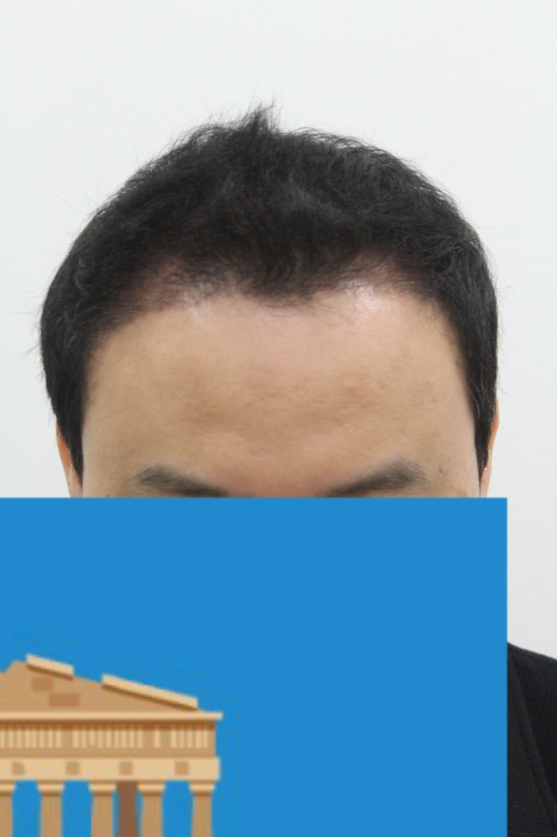 t.jpg