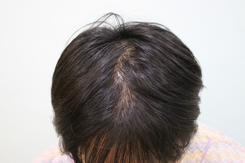수술전 (15).JPG