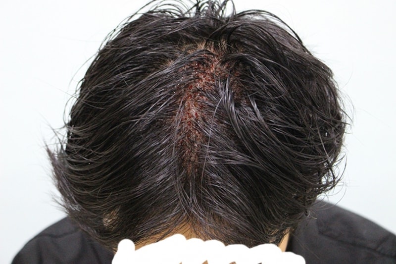 수술직후 (10).JPG