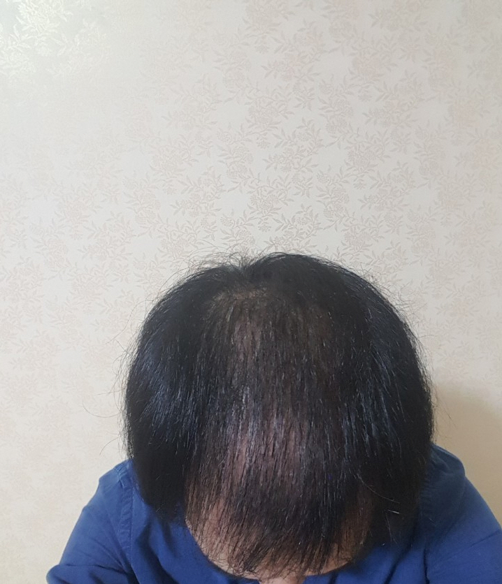 사본 -KakaoTalk_20170911_231755363.jpg