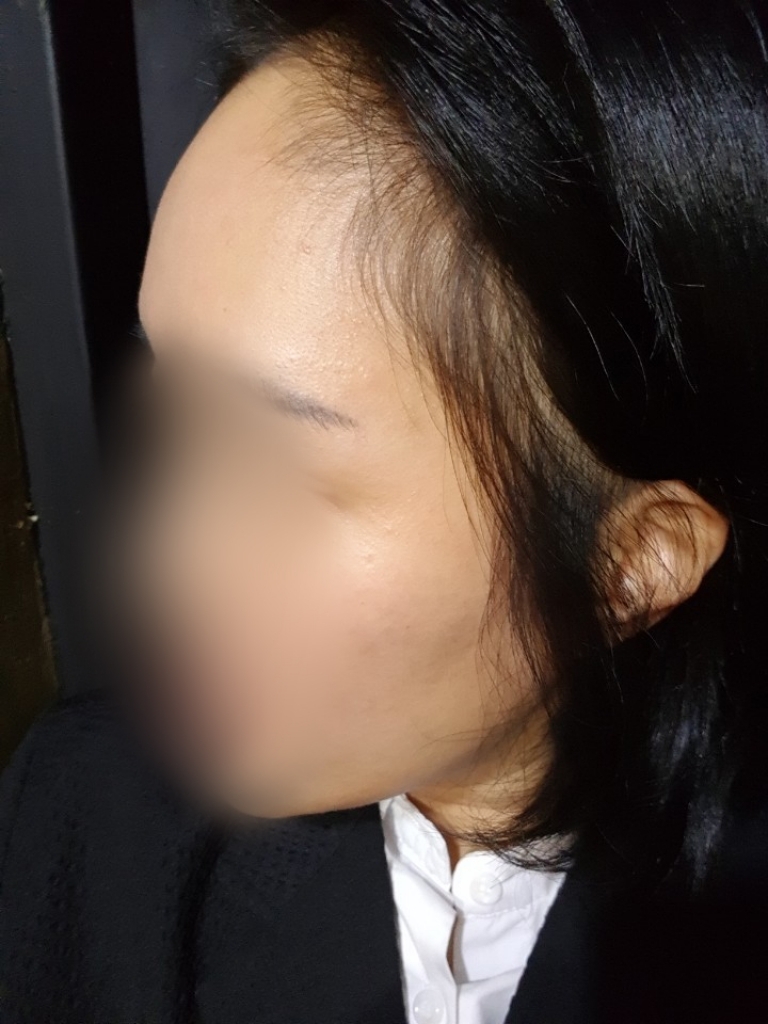 07.수술당일2.jpg