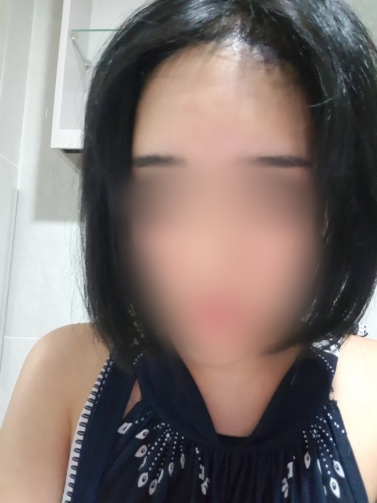 11.수술1일1.jpg