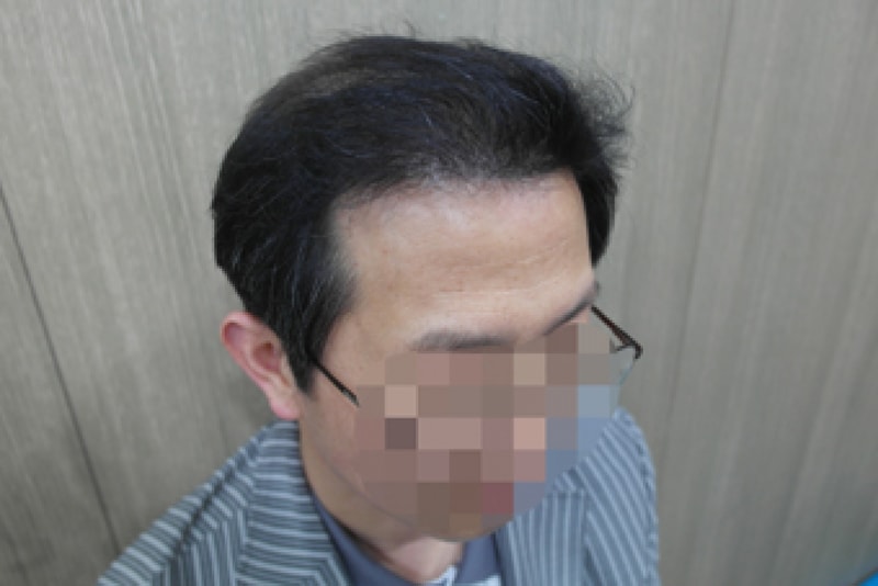 5개월 (10).JPG