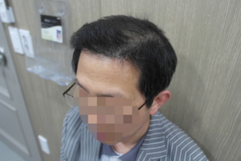 5개월 (19).JPG