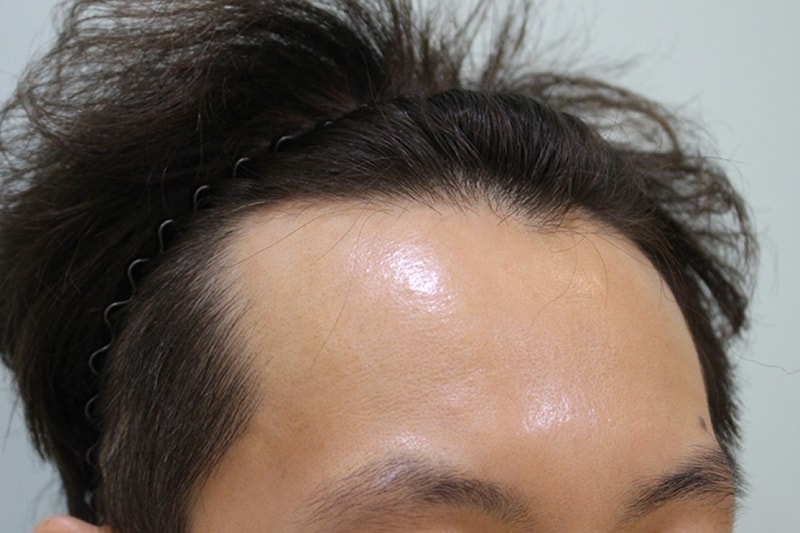수술전 (6).JPG