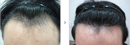 bozarhair_com_20120612_191026.png
