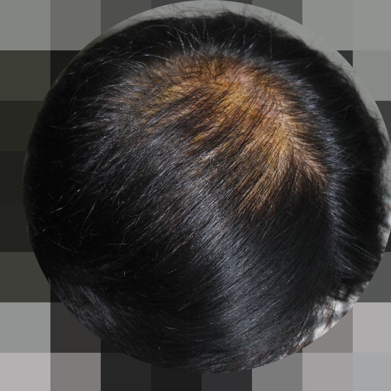 IMG_6605_8개월.png