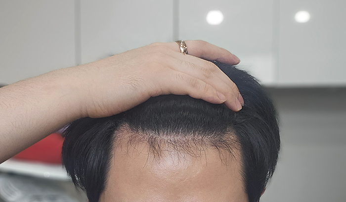 2. 암흑기라 많이 빠진 상태에요.jpg