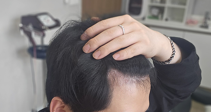 4. 주사 맞고 찍어봤습니다.jpg